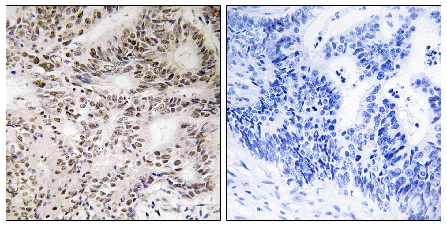 Polyclonal Rabbit anti-Human ARAF / ARAF1 / A-RAF Antibody (phospho-Ser299, IHC)
