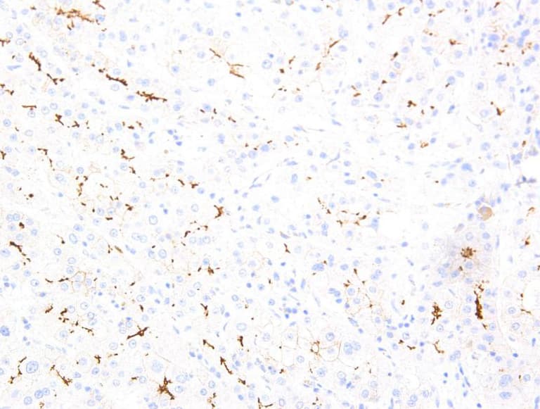 ABCB11 / BSEP Antibody (clone AHC0021)