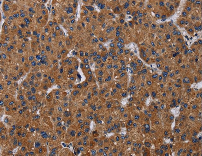 LZTFL1 Antibody