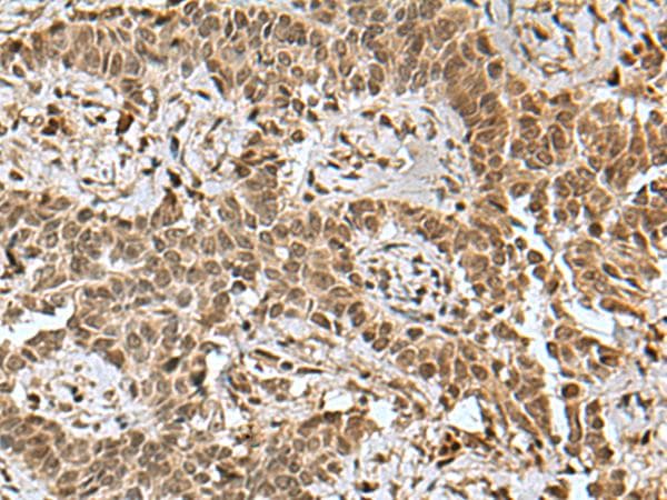 BCL7B Antibody