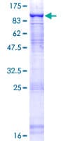 Human CDC40 Protein (Recombinant GST)