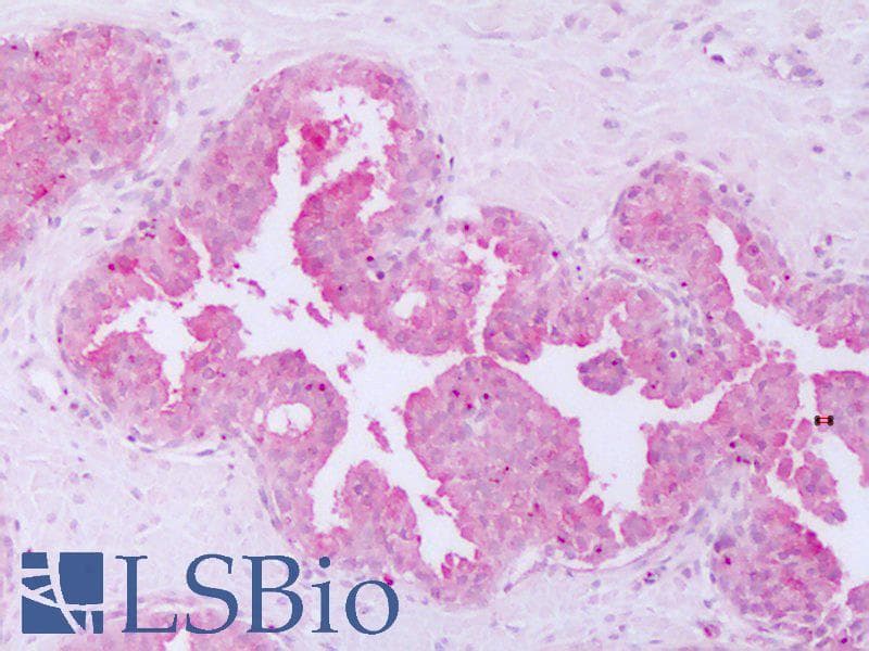 IHC-plus™ HUNK / B19 Antibody (Internal)