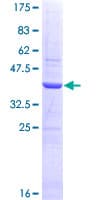 Human SHBG Protein (Recombinant GST, N-terminus)