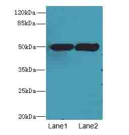 TUBA3E / Tubulin Alpha 3E Antibody