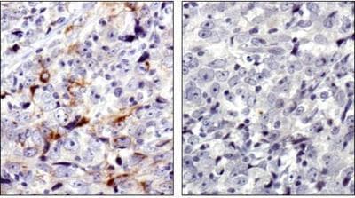 MMP7 / Matrilysin Antibody