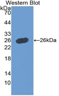 PathPlus™ GH / Growth Hormone Antibody (aa28-217)