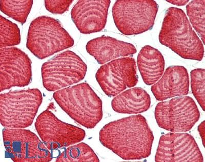 IHC-plus™ Polyclonal Rabbit anti-Human PER2 Antibody (aa636-685, IHC, IF)