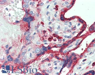 IHC-plus™ Polyclonal Rabbit anti-Human LGMN / Legumain Antibody (aa83-112, IHC, WB)