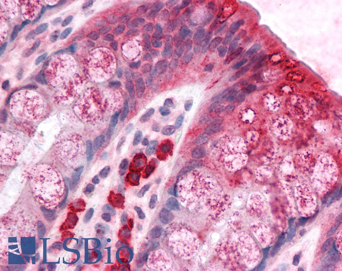 IHC-plus™ BCAS1 / NABC1 Antibody