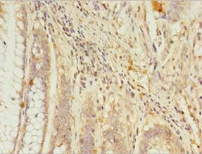 Polyclonal Rabbit anti-Human RGS7 Antibody (IHC)