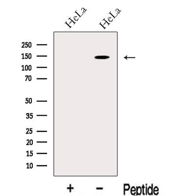 Polyclonal Rabbit anti-Human LARS / Leucyl-TRNA Synthetase Antibody (WB)