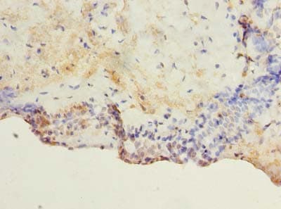 TM4SF1 Antibody