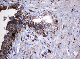 PathPlus™ HSPD1 / HSP60 Antibody (clone OTI3A2)