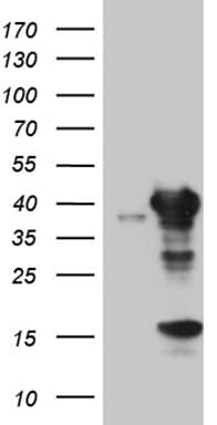 UROD Antibody (clone OTI2G7)