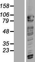CNOT3 Protein (Over-Expression Lysate Myc-DDK (Flag))