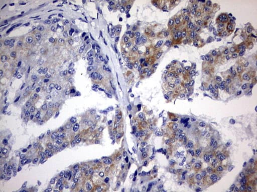 Monoclonal Mouse anti-Human CHCHD3 Antibody (clone OTI2A6, aa2-227, IHC, WB)