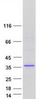 Human SLIM / FHL1 Protein (Recombinant Myc-DDK (Flag))