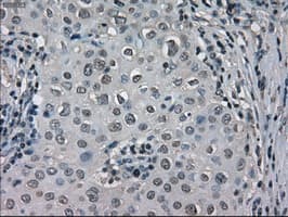 Monoclonal Mouse anti-Human LDHA / LDH1 Antibody (clone OTI2D11, IHC, WB)