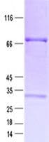 Human AR / Androgen Receptor Protein (Recombinant GST, N-terminus + His, C-terminus)