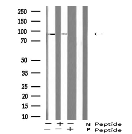 ATRIP Antibody (phospho-Ser224)