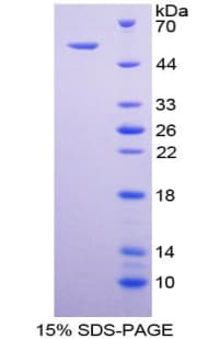 Human TNFRSF10B / Killer / DR5 Protein (Recombinant His-GST)
