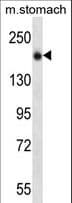 UNC13B Antibody (aa263-292)