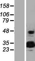 EFCAB2 Protein (Over-Expression Lysate Myc-DDK (Flag))