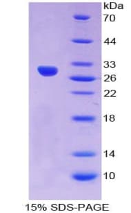 Human CRY Protein (Recombinant His-S)