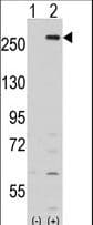 KPI-2 / LMTK2 Antibody (aa668-697)