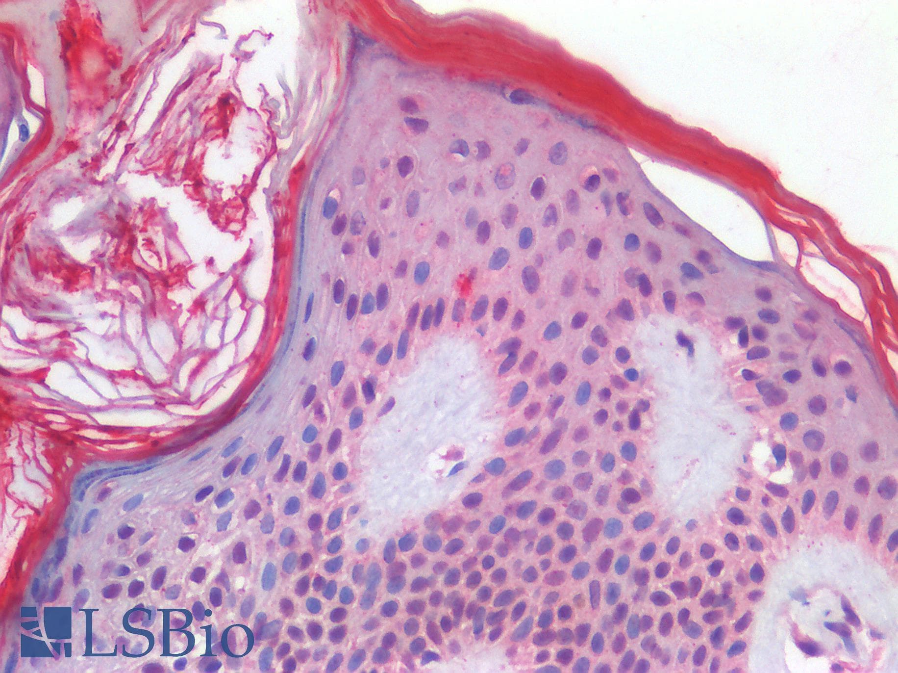 IHC-plus™ Polyclonal Rabbit anti-Human TP63 / p63 Antibody (IHC)