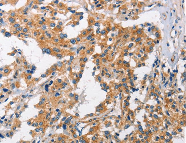 CHMP1A Antibody