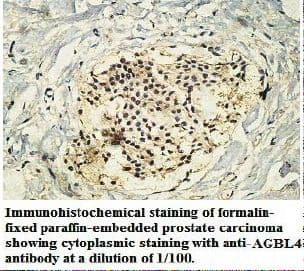 AGBL4 Antibody (aa109-268)