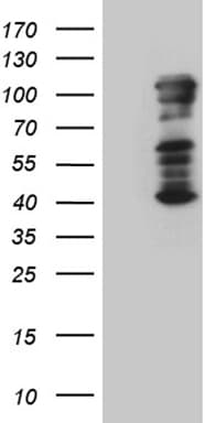 TBX3 Antibody (aa244-481, clone OTI7C4, Carrier-free)