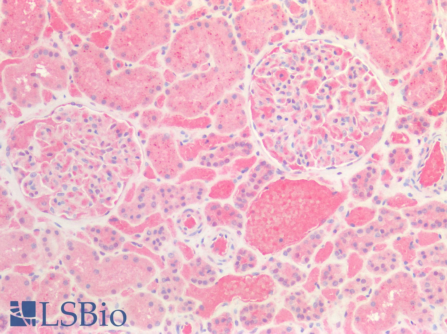 IHC-plus™ TTR / Transthyretin Antibody