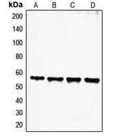 FGL2 Antibody (N-Terminus)