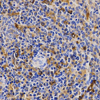 CDK20 / CCRK Antibody