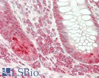 IHC-plus™ EIF4A1 Antibody (clone M8)