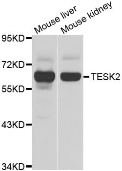 Polyclonal Rabbit anti-Human TESK2 Antibody (IHC, IF, WB)