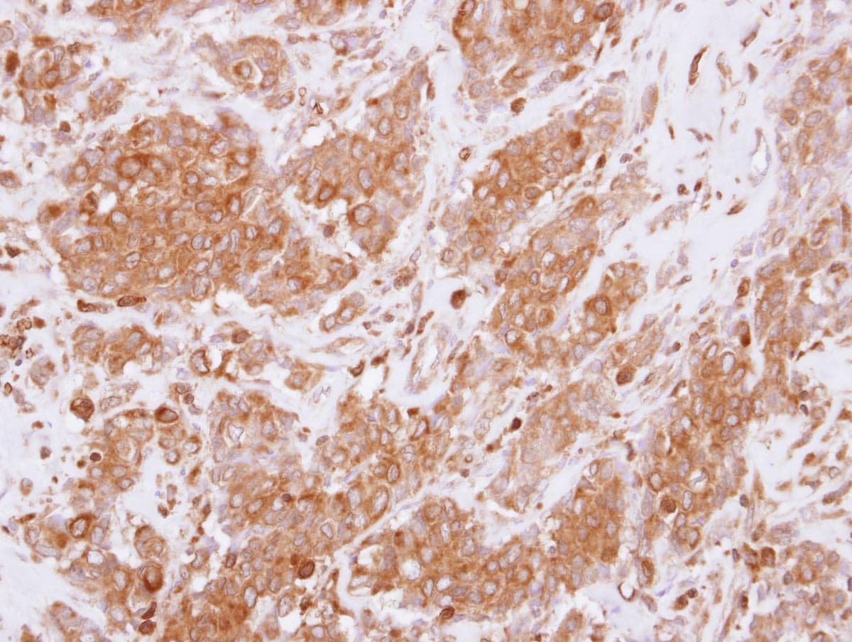 Polyclonal Rabbit anti-Human RGS10 Antibody (aa1-173, IHC, WB)