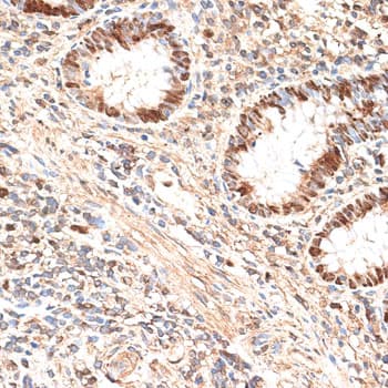 Polyclonal Rabbit anti-Human MCM5 Antibody (IHC, WB)