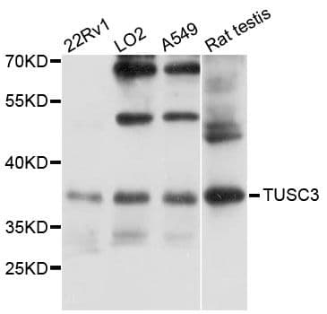 TUSC3 Antibody
