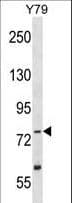 Polyclonal Rabbit anti-Human TLK2 Antibody (aa141-171, WB)
