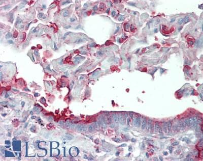 IHC-plus™ SLC34A2 / NaPi-2b Antibody (C-Terminus)