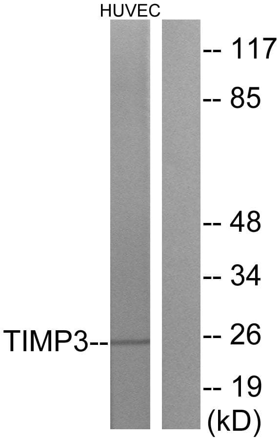 TIMP3 Antibody