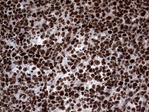 SH3BGRL Antibody (clone OTI8F7)
