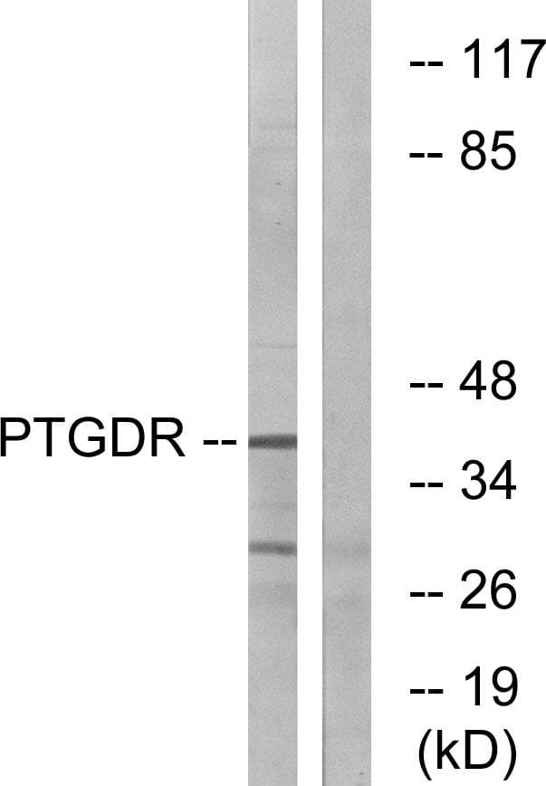 Polyclonal Rabbit anti-Human Prostaglandin D2 Receptor Antibody (IF, WB)