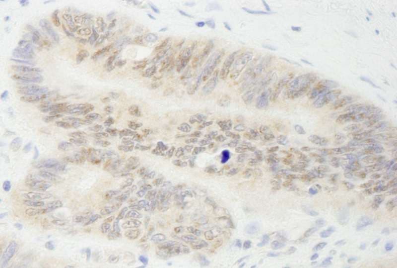 Polyclonal Rabbit anti-Human MYBBP1A Antibody (aa450-500, IHC)