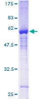 Human ZNF277 Protein (Recombinant GST)