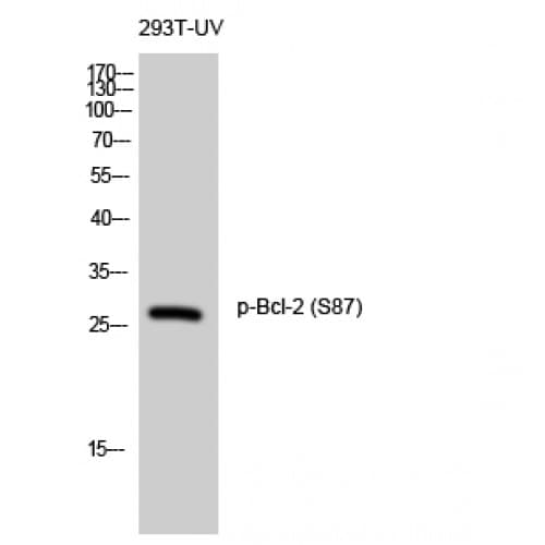 BCL2 / Bcl-2 Antibody (30-110 aa)