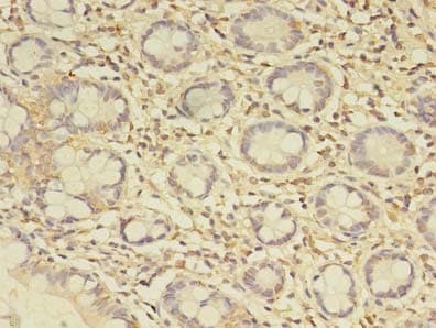 C19orf47 Antibody